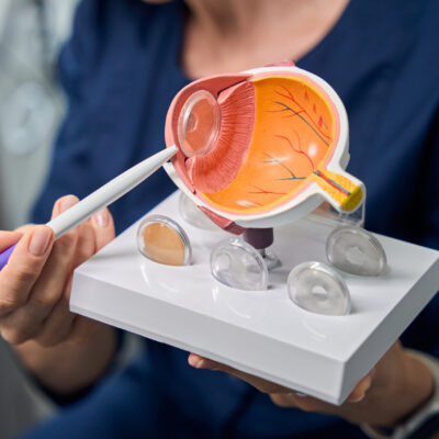 Close-up of doctor holding an eye model Detailed view of an eye model held by the doctor, highlighting the internal structures with a pointer